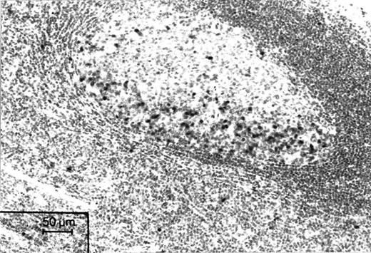 Fig. 1. Immunohistochemical staining of a microwave-processed paraffin section of a formalin-fixed human tonsil with Ki-S2. Cell nuclei in the dark zone of a germinal center, which harbors proliferating cells, are strongly positive. APAAP staining.