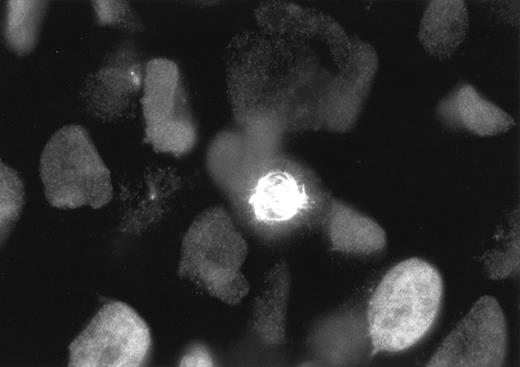Fig. 3. Staining of L428 cells with Ki-S2 and a Cy3-labeled goat antimouse polyclonal antibody. During the different phases of mitosis, the Ki-S2 antigen is strongly associated with the spindle poles and the mitotic spindle, whereas in the S and G2 phases, cells the antigen is diffusely distributed throughout the cell nucleus.