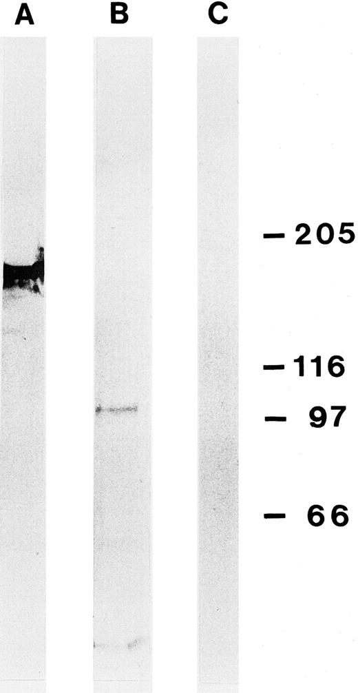 Fig. 4. Western blot of lysed L428 cells using the MoAb Ki-S2 (B) after SDS-PAGE (gradient gel 5% to 10%). Ki-S2 detects a protein of about 100 kD. (A) Control experiment with an MoAb of the same isotype (IgG1) specific for topoisomerase-IIα (170 kD). (C) Control without primary antibody. Molecular weight standards are shown on the right (in kilodaltons).