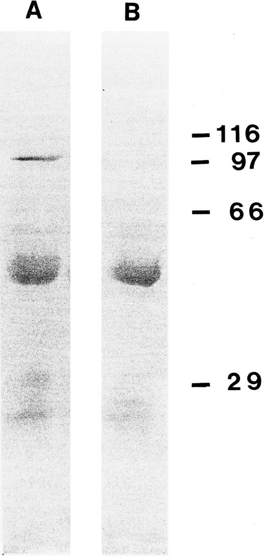 Fig. 7. A Coomassie blue staining of a PVDF membrane after an immunoprecipitation experiment using cell nuclei of 1 × 1010 HeLa cells with Ki-S2. The 100-kD protein band of this experiment was excised and used for digestion with Lys C and peptide sequencing. Molecular weight standards are shown on the right (in kilodaltons).