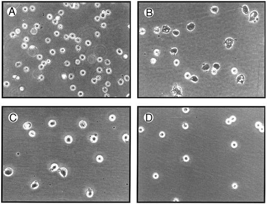 Fig. 2. Photomicrographs of SMS-SB cells.Cultures of SMS-SB cells in PFHMII were established at normal cell density (<105 cells/mL; A), or at low cell density (2.5 × 104 cells/mL) in the absence (B) or presence of 10 ng/mL (C) or 100 ng/mL sCD23 (D). After 24 hours of culture, the cells were inspected by bright field light microscopy under a 40× magnification.
