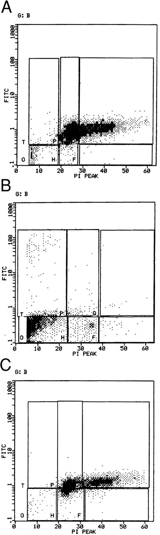 Fig. 4. Flow cytometric analysis of bcl-2 expression in SMS-SB cells. SMS-SB cells were cultured as described in the legend to Fig 3, harvested and washed. The cells were gently permeabilized in 0.1% (wt/vol) saponin-containing buffer and treated with monoclonal anti-bcl-2 antibody. After incubation for 20 minutes on ice, the cells were washed and an aliquot of FITC-anti-mouse IgG added to visualize the primary MoAb. After further incubation and washing, the cells were treated with 100 μg/mL propidium iodide and immediately analyzed by flow cytometry. In the dot plots illustrated, the X-axis illustrates propidium iodide staining in linear units of fluorescence, while the Y-axis represents bcl-2 staining on a logarithmic scale. The experiment shown is representative of three repeats. (A) Normal cell density. (B) Low cell density. (C) Low cell density + 100 ng/mL sCD23.