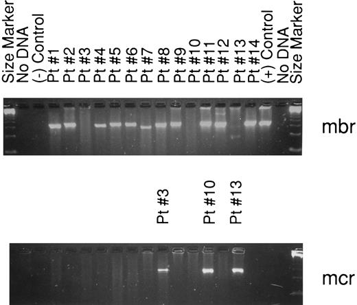 Fig. 1. Agarose gel (2%) showing the 14 patients with a bcl-2 rearrangement by PCR. The top gel demonstrates all the bcl-2–positive cases. Bands are seen using mbr primers in all lanes except 3, 10, and 13. These three cases are shown in the lower gel and are positive for mcr rearrangements.