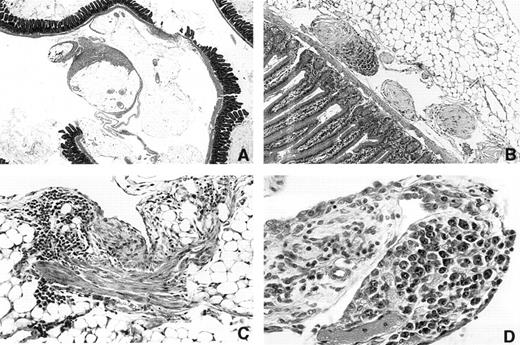 Fig. 4. Photomicrographs of peritoneal surfaces in mice carrying Lucite 21× 2 mm plastic discs. (A) 3616 1.5 × 2× Day 315. Section through mesenteric fat and intestine showing patchy fibrous deposition on mesothelial surfaces of mesenteric fat. Note that much of the surface is not covered. (B) 3173 20 × 10× Day 214. Region near the mesenteric attachment site containing three polyp-like structures. The two light staining polyps contain fibrinoid tissue covered with mesothelium. The third polyp is invaded by plasmacytoma cells. (C) 3164 20 × 5× Day 214. A patch of fibrous tissue on a fat surface on the left. The tissue contains numerous lymphocytes. (D) 3333 20 × 5× Day 258 Vascularized polyp-like structure arising from the omentum that contains a focus of atypical plasma cells. This was the only plasma cell lesion found in this mouse.
