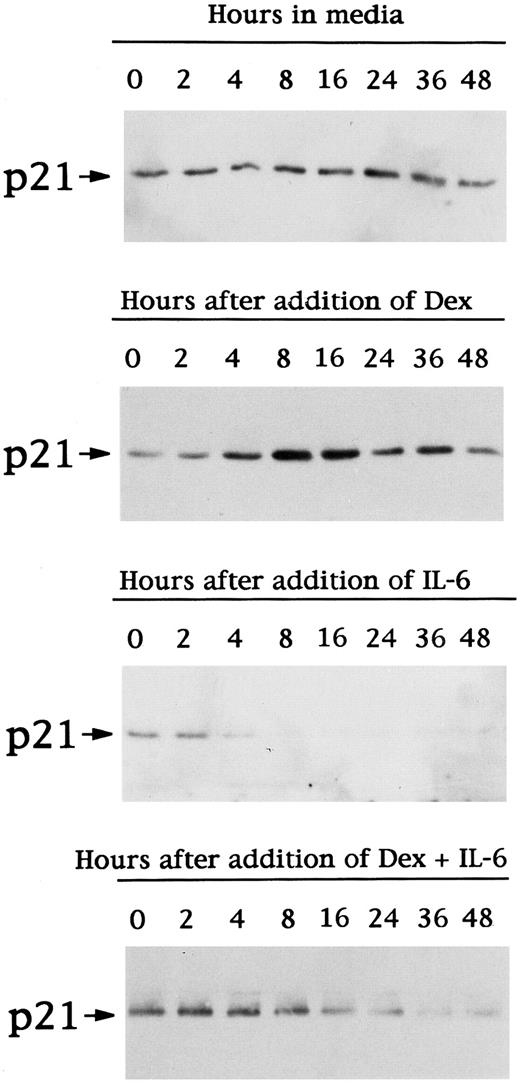 Fig. 3. Time-dependent effects of Dex and/or IL-6 on expression of p21 protein in OCI-My5 MM cells. Total lysates from OCI-My5 MM cells were prepared before (time 0) and after 2, 4, 8, 16, 24, 36, and 48 hours of culture with 10% FBS-Iscove's media alone, Dex (1 μmol/L), IL-6 (50 ng/mL), or Dex (1 μmol/L) + IL-6 (50 ng/mL). Cell lysates were immunoprecipitated with anti-p21 polyclonal Ab, followed by Western immunoblotting with anti-p21 MoAb.