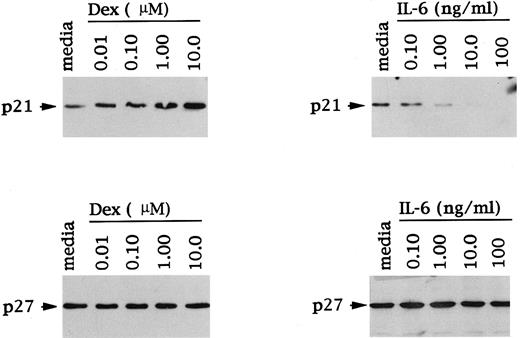 Fig. 4. Dose-dependent effects of Dex and IL-6 on p21 and p27 expression in MM cells. Total cell lysates were prepared from OCI-My5 MM cells after 16 hours of culture with Dex (0.01 to 10 μmol/L) or IL-6 (0.10 to 100 ng/mL). Lysates were immunoprecipitated with anti-p21 or anti-p27 polyclonal Abs, followed by Western immunoblotting with anti-p21 or anti-p27 MoAbs.