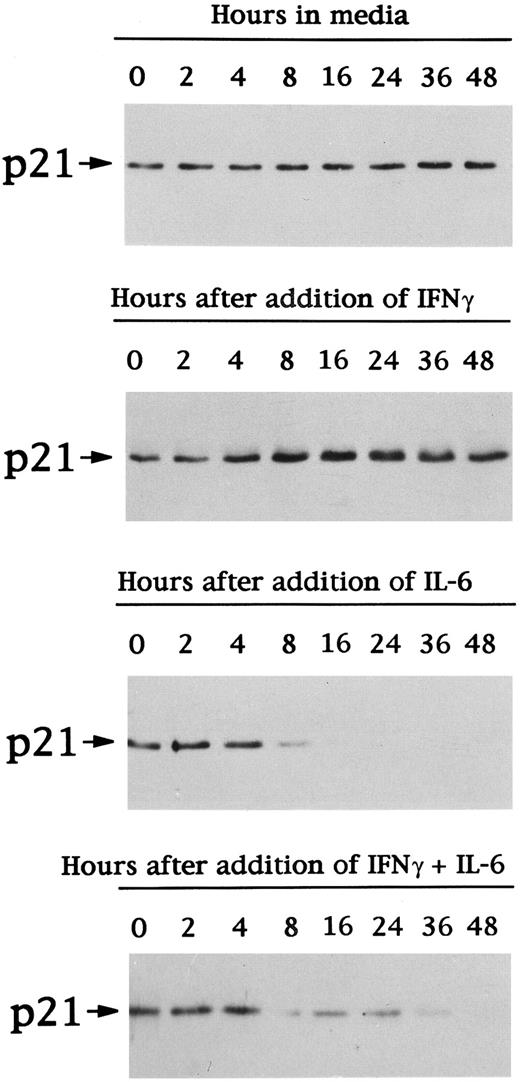 Fig. 7. Effects of IFN-γ and/or IL-6 on expression of p21 protein in patient MM cells. Total lysates from MM cells of patient no. 1 were prepared before (time 0) and after 2, 4, 8, 16, 24, 36, and 48 hours of culture with 10% FBS-RPMI-1640 media, IFN-γ (10 ng/mL), IL-6 (50 ng/mL), or IFN-γ (10 ng/mL) + IL-6 (50 ng/mL). Total cell lysates were immunoprecipitated with anti-p21 polyclonal Ab, followed by Western immunoblotting with anti-p21 MoAb.