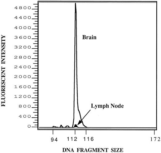 Fig. 4. Detection of HPB-ALL DNA in brain and cervical lymph node. One microgram of DNA from either the brain or cervical lymph node of the same animal was subjected to amplification by PCR using the fluorescent primers described. One microliter of the resulting reaction mixture was subjected to fractionation on a 6% denaturant polyacrylamide gel containing 8 mol/L urea and run for 3 hours in the Model 373 Genetic Analyzer (Applied Biosystems) and the results analyzed by Genescanner software (Applied Biosystems) as described. Signals from the brain (open graph) and lymph node (darkened graph, arrow) have been superimposed to be on the same scale. The expected fragment size of the HPB-ALL T-cell receptor VDJ region being amplified is 112 bases. After correcting for the recovery of standards, the relative areas of the brain and lymph node peaks are in the approximate ratio of 100:1.