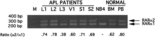 Fig. 2. Gel electrophoretic analysis of ethidium bromide-stained DNA products synthesized in primer competition experiments from RARα2 mRNA (upper band) or RARα1 mRNA (lower band). Five picomoles each of upstream primers specific for RARα1 or RARα2 were used with 10 pmol of a common downstream primer anchored in the C-region of RARα to amplify 1 μg-RNA equivalent of cDNA, as described in Materials and Methods. The abbreviations are: M, 100-bp ladder; L1 to L3, products from 3 APL patients with L-form PML-RARα mRNA; V1, product from an APL patient with V-form PML-RARα mRNA; S1 and S2, products from 2 APL patients with S-form PML-RARα mRNA; NB4, product from APL cell line NB4 mRNA; BM, product from normal bone marrow; PB, product from normal peripheral blood. All illustrated APL RNAs were derived from specimens containing greater than 90% blasts plus promyelocytes.