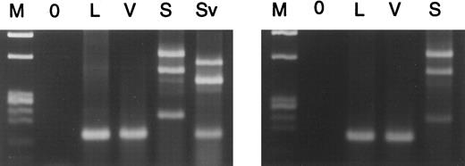 Fig. 3. Gel electrophoretic analysis of ethidium bromide–stained RT-PCR products generated from mRNAs encoding RARα1-PML (left panel) or RARα2-PML (right panel) from L-form, V-form, and S-form PML-RARα mRNA type cases, including one atypical S-form case (Sv). M is Hae III-digested φX174 DNA marker; 0 is 0 RNA control.