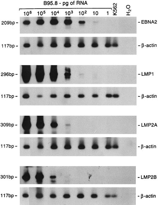 Fig. 4. Sensitivity of semiquantitative RT-PCR. Tenfold dilutions of B95.8 RNA were mixed with 1 μg of RNA from EBV− K562 cells. Multiplex RT-PCR was performed using primer pairs specific for the β-actin cellular gene and either EBNA2, LMP1, LMP2A, or LMP2B gene. Hybridization was performed with radiolabeled probes specific for each gene. The lengths of the amplified products are shown on the left.
