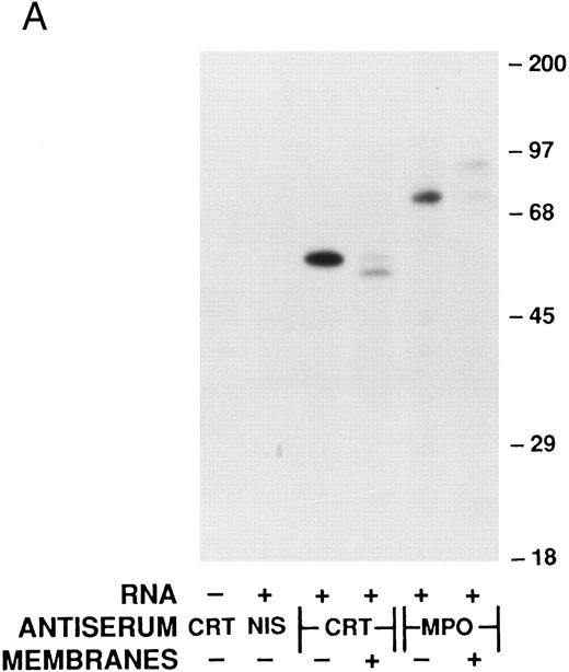 Fig. 3. Analysis of calreticulin biosynthesis in vitro. Cell-free protein synthesis was performed in the rabbit reticulocyte lysate system in the presence of 35S-methionine. Either immunoprecipitates (A and B) or total translation products (C) were analyzed by 7.5% SDS-PAGE and fluorography. The locations of molecular weight markers are indicated. (A) Reactions contained either no RNA (−) or poly-A–enriched RNA from HL-60 cells (+) and either no membranes (−) or dog pancreatic microsomes (+). The products of protein synthesis were immunoprecipitated with either nonimmune serum (NIS; from the rabbit subsequently immunized with calreticulin), anticalreticulin (CRT), or antimyeloperoxidase (MPO). (B) Reactions were as in (A) with (+) or without (−) HL-60 cell RNA and dog pancreatic microsomes. HL-60 cell calreticulin biosynthetically labeled as in Fig 2 was run (third lane from left) for comparison with the cell-free products. For all samples products of translation were immunoprecipitated with anticalreticulin. / (C) Reactions contained no RNA (−) or synthetic mRNA generated from plasmid templates of the cDNA for either calreticulin (CRT) or myeloperoxidase (MPO).