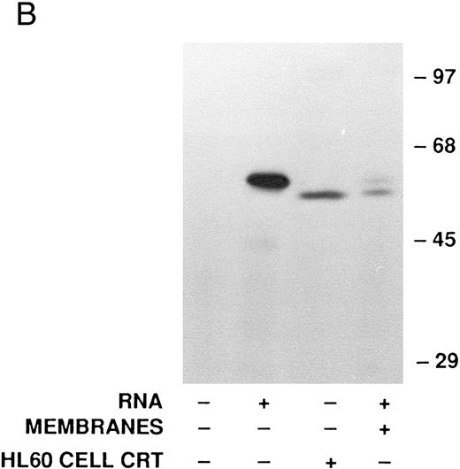 Fig. 3. Analysis of calreticulin biosynthesis in vitro. Cell-free protein synthesis was performed in the rabbit reticulocyte lysate system in the presence of 35S-methionine. Either immunoprecipitates (A and B) or total translation products (C) were analyzed by 7.5% SDS-PAGE and fluorography. The locations of molecular weight markers are indicated. (A) Reactions contained either no RNA (−) or poly-A–enriched RNA from HL-60 cells (+) and either no membranes (−) or dog pancreatic microsomes (+). The products of protein synthesis were immunoprecipitated with either nonimmune serum (NIS; from the rabbit subsequently immunized with calreticulin), anticalreticulin (CRT), or antimyeloperoxidase (MPO). (B) Reactions were as in (A) with (+) or without (−) HL-60 cell RNA and dog pancreatic microsomes. HL-60 cell calreticulin biosynthetically labeled as in Fig 2 was run (third lane from left) for comparison with the cell-free products. For all samples products of translation were immunoprecipitated with anticalreticulin. / (C) Reactions contained no RNA (−) or synthetic mRNA generated from plasmid templates of the cDNA for either calreticulin (CRT) or myeloperoxidase (MPO).