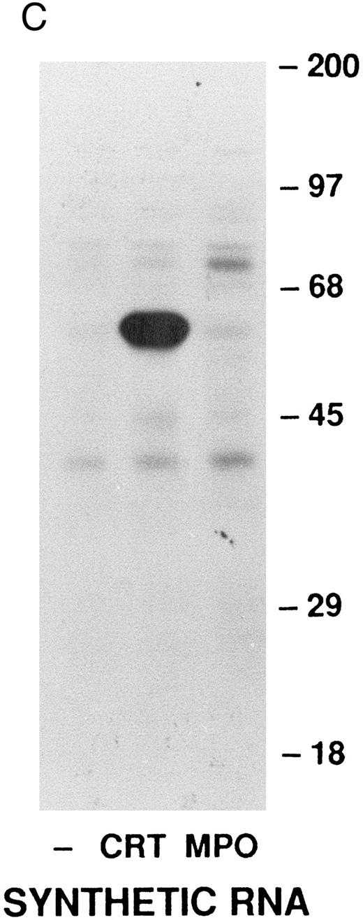 Fig. 3. Analysis of calreticulin biosynthesis in vitro. Cell-free protein synthesis was performed in the rabbit reticulocyte lysate system in the presence of 35S-methionine. Either immunoprecipitates (A and B) or total translation products (C) were analyzed by 7.5% SDS-PAGE and fluorography. The locations of molecular weight markers are indicated. (A) Reactions contained either no RNA (−) or poly-A–enriched RNA from HL-60 cells (+) and either no membranes (−) or dog pancreatic microsomes (+). The products of protein synthesis were immunoprecipitated with either nonimmune serum (NIS; from the rabbit subsequently immunized with calreticulin), anticalreticulin (CRT), or antimyeloperoxidase (MPO). (B) Reactions were as in (A) with (+) or without (−) HL-60 cell RNA and dog pancreatic microsomes. HL-60 cell calreticulin biosynthetically labeled as in Fig 2 was run (third lane from left) for comparison with the cell-free products. For all samples products of translation were immunoprecipitated with anticalreticulin. / (C) Reactions contained no RNA (−) or synthetic mRNA generated from plasmid templates of the cDNA for either calreticulin (CRT) or myeloperoxidase (MPO).