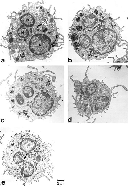 Fig. 3. Ultrastructural analysis of mBMMC. Four levels through a single mBMMC are analyzed in panels (a) through (d). The electron micrograph depicted in panel (e) shows a thin connection joining the two lobes of the nucleus of another mBMMC. N, lobes of the nucleus; D, relatively dense granules; V, relatively immature granules containing predominantly multi-vesicular structures.