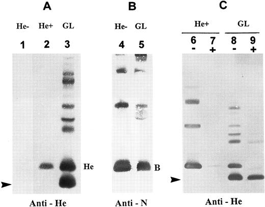 Fig. 1. Immunoblotting analysis of RBC membrane glycophorins. (A) Immunoblots probed with monoclonal anti-He. Lane designations are: 1, He−, He negative control; 2, He+, He positive control; and 3, proband GL. He monomer is seen in He+ but not He−, whereas two monomeric components of GPHe are present in GL (indicated by He and an arrow). Note that the upper bands seen in lane GL are due to overload and formation of homodimers and heterodimers with other glycophorins. (B) Immunoblots probed with monoclonal anti-N. Note that RBC membranes from proband GL contain a GPB form comparable to that from He− control (B denotes the monomeric form). (C) RBCs were treated with α-chymotrypsin and then membranes were prepared for immunoblotting with anti-He. A minus sign (−): untreated, and a plus sign (+): chymotrypsin-treated. This enzyme digestion almost completely removed the GPHe monomer with a size comparable to GPB but not at all the lower-molecular-weight GPHe species (arrow-indicated).
