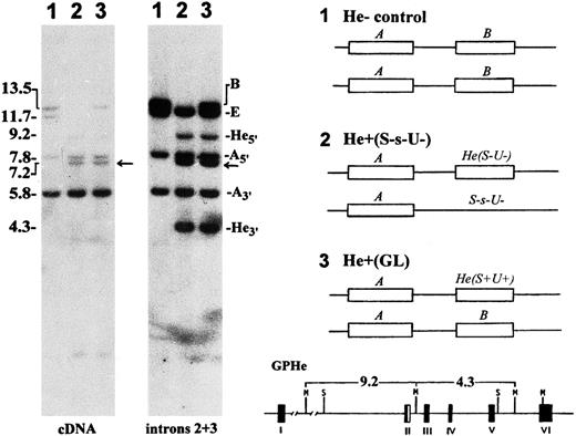 Fig. 2. Southern blot analysis of glycophorin genes. Left, genomic DNAs were digested with Msp I and hybridized with GPA cDNA and intron 2 and 3 probes, as indicated. Lanes 1, He− control (M+N+He-S+s-U+); 2, He+ control (M-N+He+S-s-U-); and 3, proband GL (M-N+He+S+s+U+). The size (kb) and gene origin of various bands are indicated at left and right margins, respectively. Arrow points to the 7.2-kb marker band known to be tightly linked with S-s-. Right, the probable genotypes for the GYPA locus in the three subjects are schematically shown in which the GPE gene is omitted for the sake of simplicity. He(S-U-) denotes nondeleted haplotype and S-s-U- GPB-deleted haplotype. GL is a heterozygote for the He(S+U+) haplotype. The GPHe gene-specific 9.2- and 4.3-kb bands originating from the introduction of a unique Msp I site into intron 2 is indicated at bottom.