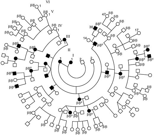 Fig. 4. Pedigree of the family showing a statistically significant linkage between HS and a β-spectrin frameshift mutation (β-spectrin Bergen or 2441insA): (•), HS patients; (○), healthy members; hematologic data as well as sequence of the β-spectrin gene were available on 15 of 23 affected patients and 32 healthy individuals at genetic risk within the family: β, normal β-spectrin allele: β0, β-spectrin Bergen. Only 2 of the 23 patients have not been splenectomized (these are III-7 and IV-16). The latter is awaiting splenectomy.