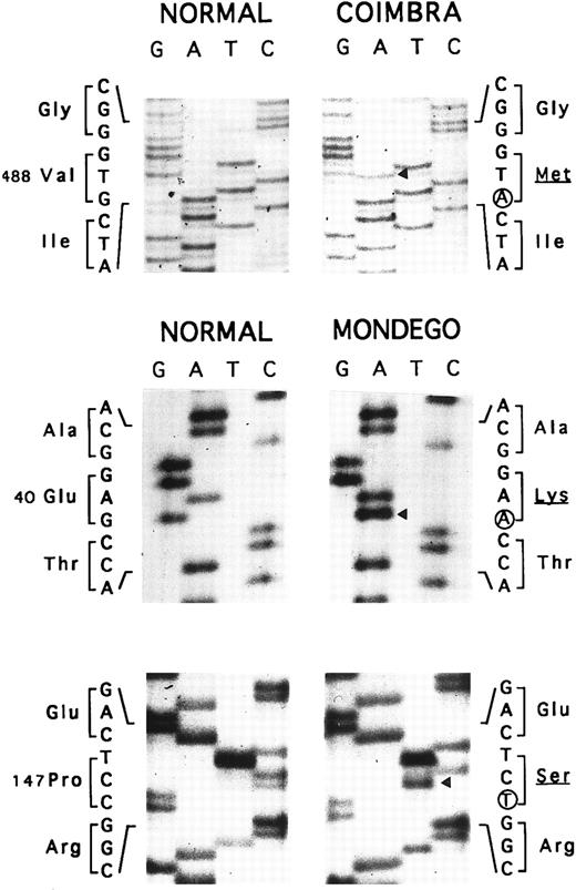 Fig. 3. Nt sequencing. Allele Coimbra (◂, V488M, GTG → ATG), direct sequencing. Allele Mondego (◂, E40K, GAG → AAG and P147S, CCT → TCT), sequencing following cloning.