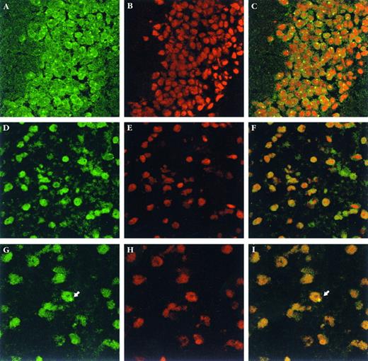 Fig. 3. Y-chromosome in situ hybridization in brain sections. (A through C) male brain sections; (D through F ) female brain sections; (G through I) transplanted female brain sections. The total number of donor cells in the brain was estimated by counting individual male cells in 1 of every 25 sagittal sections from half of the brain and then multiplying this number by 50 (see Materials and Methods for details). The arrows indicate a single male cell found in one representative section from a female transplant recipient. (A, D, and G) Show the fluorescein-labeled hybridization signal; (B, E, and H) show counterstaining with propidium iodide, and (C, F, and I) show combined images. Magnification = 1,000× for (A) through (F ), and 1,200× for (G) through (I).