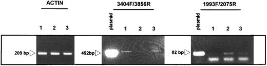 Fig. 7. Effect of antisense construct on endogenous Ptpγ expression. RT-PCR products from untransfected cells (lane 1), cells transfected with the antisense construct B (lane 2), and transfected with empty vector (lane 3); plasmid indicates the murine Ptpγ cDNA cloned in the Bluescript SK-vector and used as a control for the size of the expected PCR product and the success of the reaction. Actin indicates the amplification of the 209-bp product derived from murine actin mRNA. 3404F/3856R and 2993F/2075R indicate the sequence numbers of the first nucleotide amplified by the specific 5′ primer (F ) and the sequence number of the last 3′ nucleotide (R). Next to the open arrow is the size of the amplified product. The PCR reaction was performed for a longer number of cycles (35) then the samples in Fig 1, to detect minute amounts of transcripts.