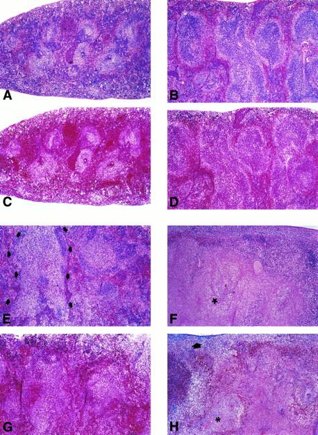 Fig. 4. Histological examination of spleen pathology. Spleen sections from control (A through D) and FL-overexpressing (E through H) animals at 2 weeks posttransplantation (A, C, E, and G) or 6 weeks posttransplantation (B, D, F, and H) are shown. H&E-stained sections are shown in (A), (B), (E), and (F) and Masson's trichrome-stained sections are shown in (C), (D), (G), and (H). In control mice, normal splenic architecture is regained over the 6-week period posttransplantation, with no evidence of fibrosis (blue staining) demonstrated by Masson's trichrome staining. In contrast, FL-overexpressing mice develop enlarged splenic white pulp (E; arrowheads) by 2 weeks posttransplantation. No appreciable focal collagen deposition occurred by 2 weeks posttransplantation (G). By 6 weeks posttransplantation, massive splenic necrosis was evident (F; star), with evidence of fibrosis in the splenic parenchyma (H; asterisk) and adjacent to the capsule (H; broad arrow). All photomicrographs were captured with a 6× objective.