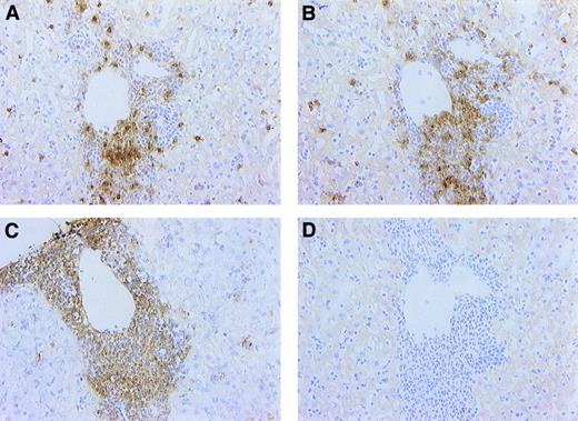 Fig. 6. Hepatic cellular infiltrates are composed predominantly of T lymphocytes and dendritic cells. Sections from FL-overexpressing animals at 6 weeks posttransplantation were stained immunohistochemically with antibodies against CD3 (A), dendritic cell (NLDC145; B), and CD11c (C) antigens or with a negative isotype control (in this case, rabbit IgG; D), as described in Materials and Methods. Note that the cellular infiltrate is comprised largely of CD3+ or NLDC145+ cells and that most cells were CD11c+. All photomicrographs were captured with a 40× objective.
