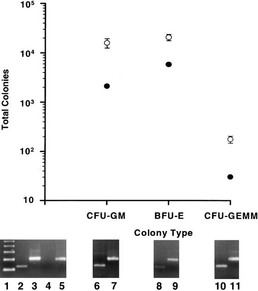Fig. 6. Human myeloid colony-producing potential in vitro of input cell fractions and of output cells from the BMs of repopulated mice. Total GM, erythroid (BFU-E), and GEMM colonies are plotted for 1 × 105 input cells from experiment 4 (•). BM cells from five mice that had each been infused with 1 × 105 input cells and allowed to engraft for 10 weeks were plated into the CFU assay. The means and SE of the total CFU in each category are plotted (○). All colonies analyzed by a human-specific PCR (at least 30 colonies/CFU type/mouse) were of human origin. Typical PCR signals are shown below specific colony types for human Cart-1 (lanes 6, 8, and 10) and for β-actin (lanes 7, 9, and 11). Controls consisted of PCRs for human Cart-1 (lanes 2 and 4) and β-actin (lanes 3 and 5) from human PB leukocytes (lanes 2 and 3) and normal mouse BM cells (lanes 4 and 5). Lane 1 shows a 123-bp ladder. The predicted amplified products for the hu Cart-1 PCR and for the β-actin PCR are 156 and 249 bp, respectively.