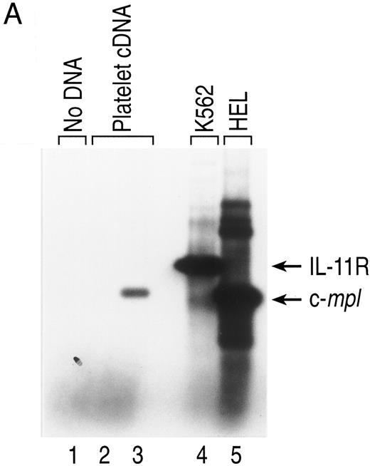 Fig. 7. Expression of IL-11 receptor α chain in human platelets. (A) Total RNA from human platelets, K562 cells, and HEL cells was isolated and analyzed via RT-PCR as described in Fig 4. The DNA fragments were visualized by including digoxigenin-11-dUTP in the PCR mix and using an immunochemiluminescent detection system. Autoradiography of the membrane filter was performed for 2 hours. The primers used generated the fragments described in Fig 4: human IL-11R (lanes 1, 2, and 4) and human c-mpl (lanes 3 and 5). Lane 1, no cDNA; lanes 2 and 3, platelet cDNA from 1 × 106 cell equivalents; lane 4, K562 cDNA from 37.5 ng of polyA+ RNA; lane 5, HEL cDNA from 37.5 ng of polyA+ RNA. (B) Western blot analysis of IL-11 receptor α chain expression in human platelets. Total protein from platelets (7.5 × 107 for IL-11R and 5 × 107 for CD41) and cells (5 × 103 CHO cells, 5 × 103 CHO/IL-11R cells, and 2 × 106 K562 cells) was separated by SDS-PAGE and transferred to nitrocellulose membranes. IL-11 receptor α chain (lanes 1 through 4) and CD41 (lanes 5 and 6) were detected with 1.0 μg/mL of primary antibody. Autoradiography was performed on the membranes (CD41 for 30 seconds and IL-11 receptor for 1 hour).