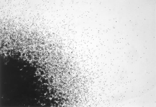 Fig. 1. A photomicrograph of a mixed NK cell colony. One quarter of a representative mixed NK cell colony seen on an inverted microscope is shown. Original magnification × 40.