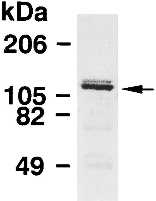 Fig. 1. Immunoblot analysis of MBS in human platelets. Platelet lysates were applied to SDS-PAGE followed by immunoblots using the antibody against MBS as described in the Materials and Methods.