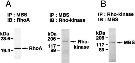 Fig. 3. Phosphorylation of MBS and inactivation of myosin phosphatase by Rho-kinase. (A) Coimmunoprecipitation of RhoA and Rho-kinase with platelet MBS. Coprecipitated RhoA (left) and Rho-kinase (right) were determined by probing immunoblots with antibodies against respective proteins. (B) Coprecipitation of MBS with Rho-kinase from human platelets. Immunoprecipitation with anti–Rho-kinase antibody and immunoblot analysis of MBS were described in the Materials and Methods. (C) In vitro phosphorylation of platelet MBS by GST-Rho-kinase and its inhibition by staurosporine. MBS immunoprecipitates of platelet lysates were incubated with Rho-kinase in the presence of staurosporine, as described under Materials and Methods. Protein phosphorylation was analyzed by SDS-PAGE, followed by autoradiography. Lane 1, no incubation; Lane 2, 15 minutes of incubation without GST-Rho-kinase; Lane 3, 15 minutes of incubation with GST-Rho-kinase, Lane 4; 15 minutes of incubation with GST-Rho-kinase in the presence of 1 μmol/L staurosporine. The results are representative of three independent experiments. (D) Effect of MBS phosphorylation on the activity of myosin phosphatase. MBS immunoprecipitates were incubated without GST-Rho-kinase (▵, ▴), with GST-Rho-kinase (□, ▪) or with GST-Rho-kinase and 1 μmol/L staurosporine (○, •), as described in the Materials and Methods. At the indicated times, aliquots of the reaction mixture were quenched by addition of a solution containing final 10 mmol/L EGTA to stop the reaction and were kept on ice. Activity of myosin phosphatase (open symbol) was determined immediately. Phosphorylation (solid symbol) of MBS was analyzed by SDS-PAGE and autoradiography. Points, means of three separate experiments (SD < 10%).