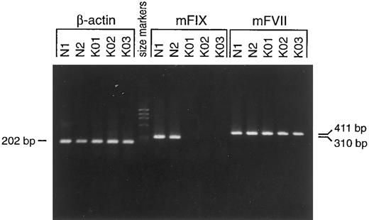 Fig. 3. Analysis of total liver RNA for the murine factor IX gene in factor IX-knockout and normal mice by RT-PCR. RT-PCR was performed as described in the Materials and Methods. A 310-bp RT-PCR product was detected in total liver RNA from wild-type but not from the factor IX-knockout mice. RT-PCR products of the factor VII (411 bp) and β-actin (202 bp) genes for the factor IX-knockout mice were no different from those of normal mice. Lanes are as follows: N1 and N2, normal male mice; KO1, KO2, and KO3, factor IX-knockout male mice. The primers used are for the β-actin gene, the murine coagulation factor VII gene, and the murine coagulation factor IX gene as indicated.