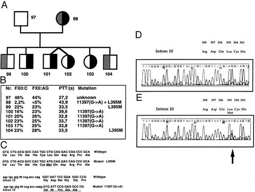 Fig. 3. (A) Pedigree of case A-98. The splice site mutation exon 14:11397 (G → A) (solid symbols) and exon 10: L395M (9988 C → A) (hatched symbols), a mutation close to His393. (B) Clotting parameters and genotypes. (C) Genomic sequence and derived amino acid sequence of wild-type and mutated exon 14.11 (D) Automated fluorescence sequence for the reverse wild-type sequence around L395. (E) Automated fluorescence sequence for the reverse mutated sequence around L395M.