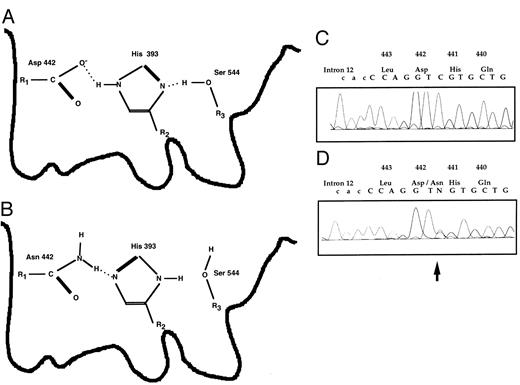 Fig. 5. The mutation D442N(10372 G → A) in the active site of the human FXII serine protease detected in case A-148, a woman with three recurrent abortions and a CRM-positive phenotype. Her coagulation parameters were as follows: prothrombin time, 92%, partial thromboplastin time 27.6 seconds, 29.9 seconds; thrombin time, 17.8 seconds; fibrinogen (Clauss), 3.2 g/L; FII, 109%; FV, 97%; FVII, 89%; FX, 120%; FVIII, <120%; FIX, <120%; FXI, 111%; FXII:C, 63%; FXII:Ag, 100%; protein S (total), 135%; protein S (free), 130%; protein C, 110%; AT III, 107%. No antiphospholipid antibodies and no factor V Leiden mutation.39 (A) Schematic structure of the active site formed by the catalytic triad of Asp442, His393, and Ser544 (according to chymotrypsin; see Fersht31 ). (B) The replacement of Asp442 by Asn gives rise to a dysfunctional structure. (C) Reverse wild-type sequence. (D and E) Heterozgous form: reverse mutated and wild-type sequences are superimposed. The arrow indicates the mutation.