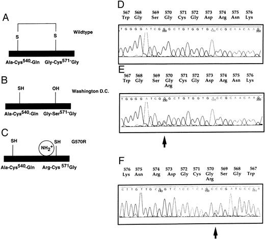 Fig. 6. Mutation in the C-terminal part. G570R (11482 G → C) found in case C-82 giving rise to a CRM-positive phenotype (FXII:C 10%, FXII:Ag 74%). (A) Wild-type protein structure of the light chain. (B) No disulfide bond formed in FXII Washington D.C. (C) Hypothetical model for FXII G570R. No disulfide bond in putative protein structure of FXII G570R. (D) Wild-type DNA sequence. (E) Heterozygous C-82. Wild-type and mutated sequences are superimposed. (F ) Reverse sequence of C-82. The arrow indicates the mutation.