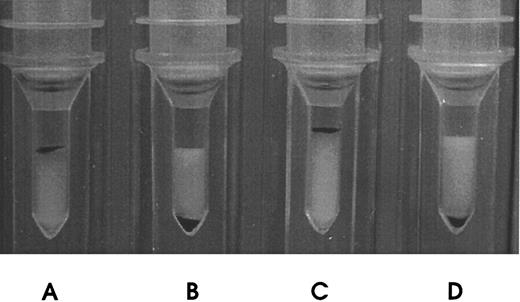 Fig. 2. Direct hemagglutination of Rh(D)-positive RBCs by mRh1. (A) Incubation of papain-treated Rh(D)-positive RBCs with DF5 MoAb (positive control). (B) Incubation of papain-treated Rh(D)-negative RBCs with mRh1. (C) Incubation of papain-treated Rh(D)-positive RBCs with mRh1. (D) Incubation of papain-treated Rh(D)-negative RBCs with culture medium (negative control). Agglutinated RBCs remained at the top of the columns.