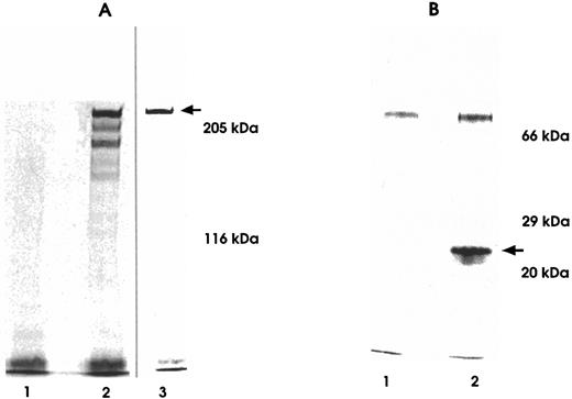 Fig. 3. SDS-PAGE analysis of 35S-labeled supernatants immunoprecipitated using anti-MYC Tag MoAb. Immunoprecipitates were run on 5% (A) and 10% (B) polyacrylamide gels under nonreducing (A-2 and A-3) and reducing conditions (B-2). Untransfected CHO cell immunoprecipitates served as negative controls (A-1 and B-1). Lane A-2 depicts a three-band heterogeneous hexamere, heptamere, and octamere profile observed under nonreducing conditions in a biosynthetic labeling experiment from a bulk of transfected cells before final cloning of cells.