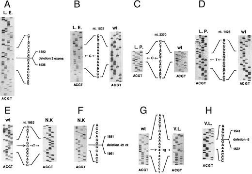 Fig. 1. Mutations of JAK3 gene in four unrelated patients affected by autosomal SCID. (A and B) cDNA sequences of the two alleles of patient L.E. (C and D) cDNA sequences of the two alleles of patient L.P. (E and F ) Sequence of genomic DNA of patient N.K. (E) that creates a new splice site causing a 21-bp deletion in his cDNA sequence (F ). (G and H) Sequence of genomic DNA from patient V.L. showing a point mutation in the invariant dinucleotide of the acceptor site of the 9th intron (G), causing the use of a cryptic splice site 5 bp downstream of the normal one, with a consequent 5-bp deletion in the cDNA sequence (H). All exon sequences are in bold, whereas intron sequences in (G) are indicated in lower-case letters. The numbers refer to the JAK3 cDNA sequence as present in data base. w.t., wild-type. All the sequences are shown in the sense orientation, even when performed on the reverse strand.
