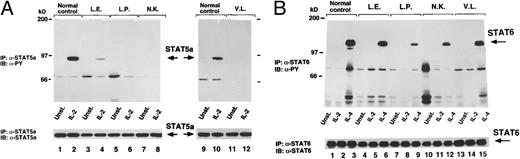 Fig. 4. (A) Cytokine-induced phosphorylation of STAT5. Control (lanes 1, 2, 9, and 10) and JAK3-deficient patients cells (lanes 3 through 6, 11, and 12) were stimulated with indicated cytokine for 15 minutes, lysed, and immunoprecipitated (IP) with STAT5A-specific antiserum (α-STAT5A). After transferring to a nylon membrane, complexes were immunoblotted (IB) with α-PY (top). The membrane was then stripped and reprobed with a-STAT5A (bottom). (B) Cytokine-induced phosphorylation of STAT6. Control (lanes 1 through 3) and JAK3-deficient patients cells (lanes 4 through 15) were left unstimulated or stimulated with IL-2 or IL-4, lysed, and immunoprecipitated (IP) with STAT6 antiserum (α-STAT6). After electro-transferring, immunocomplexes were immunoblotted (IB) with phosphotyrosine-specific monoclonal antibody (α-PY, top). The same membrane was then stripped and reprobed with α-STAT6 (bottom).
