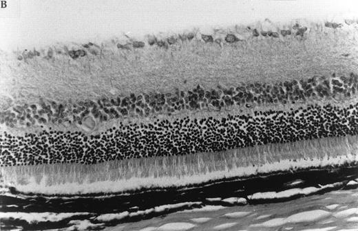 Fig. 7. Histologic ocular changes observed in (LEW × BN) F1 rats 35 days after S Ag immunization. (A) In the control rat injected only with S Ag, there is destruction of the photoreceptor cell layer and most of the bipolar cell layer with the presence of inflammatory cells. (B) In a rat treated with IVIgM, there is complete integrity of the retinal structure (Hematoxylin eosin, original magnification × 270).