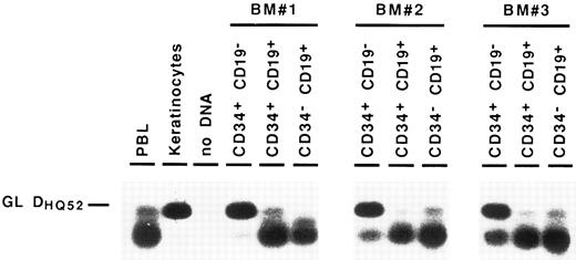 Fig. 3. Detection of partial DJH rearrangements in BM cell fractions. DNA from cell lysates was amplified with a mixture of consensus primers for most of DH gene families and a consensus JH primer. PCR products were visualized by Southern blot hybridization using an internal consensus JH probe. GL DHQ52 indicates the amplification, from a germline IgH locus, of the DNA segment located between the most 3′ DH gene (DHQ52 ) and the most 5′ JH gene (JH1 ), producing a 160-bp product.