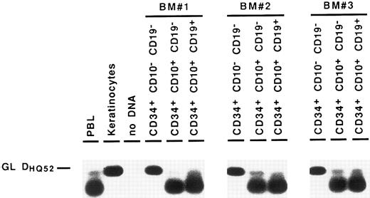 Fig. 5. Detection of partial DJH rearrangements in BM CD34+ fractions. Amplification of the germline DHQ52-JH1 DNA segment (GL DHQ52 ) served as an internal control for DNA integrity.