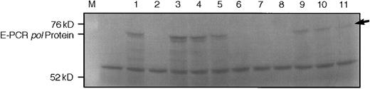 Fig. 4. HERV-K–related genomic and platelet RT-PCR–derived clones encode an apparently full-length pol protein. (A) shows SDS-PAGE of E-PCR products detected by fluorography. Lanes are (from left to right) M, marker; −, reticulocyte lysate, no exogenous DNA added; 1 through 9, individual HERV-K–related clones; 10, MPMV control; 11, HERV-K10. The arrow indicates the full-length protein produced by HERV-K10.