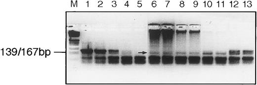 Fig. 6. Platelet lysate RT preferentially uses an RNA template. RT assay of sucrose fraction 17 from patient UPN08. Lanes are (from left to right) M, marker; 1 through 5, 2.0, 0.2, 0.02, 0.002, and 0.0002 U of Moloney murine leukemia virus reverse transcriptase; 6 through 13, 1.0 μL of sucrose fraction in duplicate with activated DNA added as follows: lanes 6 and 7, 10 μg; 8 and 9, 1 μg; 10 and 11, 0.1 μg; and 12 and 13, no activated DNA added. The arrow indicates the signal from the RT. Note that the activated DNA can be seen at the top of the gel at the higher concentrations.