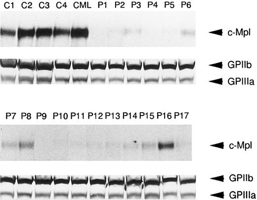 Fig. 3. Western blot analysis of c-Mpl and GPIIb/IIIa expression in the platelets from ET patients (P1 to P17), a CML patient (CML), and normal controls (C1 to C4). The platelet lysates (15 μg each lane) were separated by SDS-PAGE and probed with either anti-c-Mpl or anti-GPIIb/IIIa antiserum.