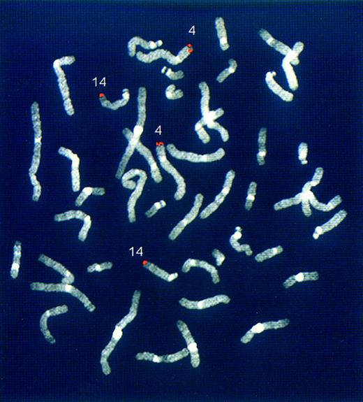 Fig. 3. Chromosomal mapping of the novel genomic regions rearranged with the IGH locus in case LB375. FISH experiments were performed on normal human metaphases using the rearranged LB375 clone (see Fig 2) as probe. The hybridization signals (red) are located at 14q32 and 4p16.3 chromosomes.