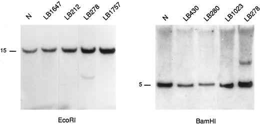 Fig. 4. Southern blot analysis of representative MM samples using 4p16.3 probes. The DNAs were digested with the indicated restriction enzymes and hybridized with the A/Bg 1.3 probe (see Fig 2). A rearranged fragment is observed in case LB278 (see text). Germ-line bands are indicated in kilobases (kb).
