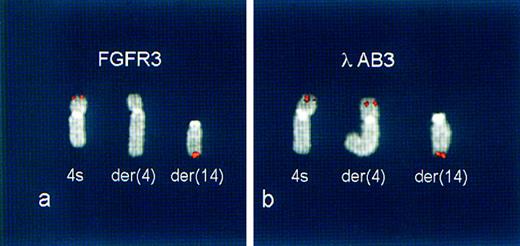 Fig. 5. FISH analyses of KMS-11 cell line. (A) Partial metaphase hybridized with a FGFR3 cDNA clone HE8.31 The signals (red) are evident at the 4p16.3 telomeric region of a shorter chromosome 4 (4s) and at the telomeric region of chromosome 14q, der(14), while absent in the normal chromosome 4 homolog, der(4). (B) Partial karyotype from a metaphase hybridized with phage λAB3 (see Fig 2). Signals (red) were found on the shorter chromosome 4 (4s), on der(4), and on der(14), indicating that the 4p16.3 breakpoint occurred within the genomic region represented by this clone.