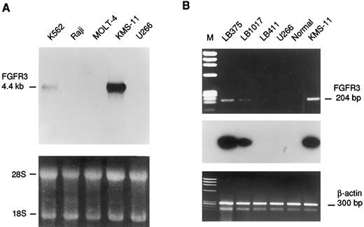 Fig. 6. Expression analysis of the FGFR3 gene. (A) Northern blot analysis of human leukemic cell lines. The length of the FGFR3 transcript is indicated in kb. Ethidium bromide staining is shown below for loading quantification. (B) RT-PCR analysis of FGFR3 expression in MM biopsies (LB375,LB1017, LB411), cell lines (U266, KMS-11), and bone marrow from a normal donor (Normal). The length of the FGFR3 amplified fragment is shown in base pairs. The hybridization with an internal fragment obtained by nested PCR is shown below. The amplification of specific sequences of the β-actin gene is also shown as template control.